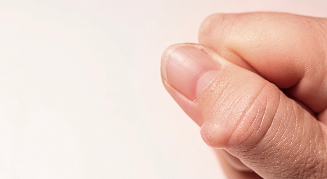 ¿Lipoma? Especialista en Salud explica qué es y cuándo consultar al médico