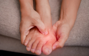 ¿Juanete? Una deformidad progresiva del pie que puede afectar la calidad de vida