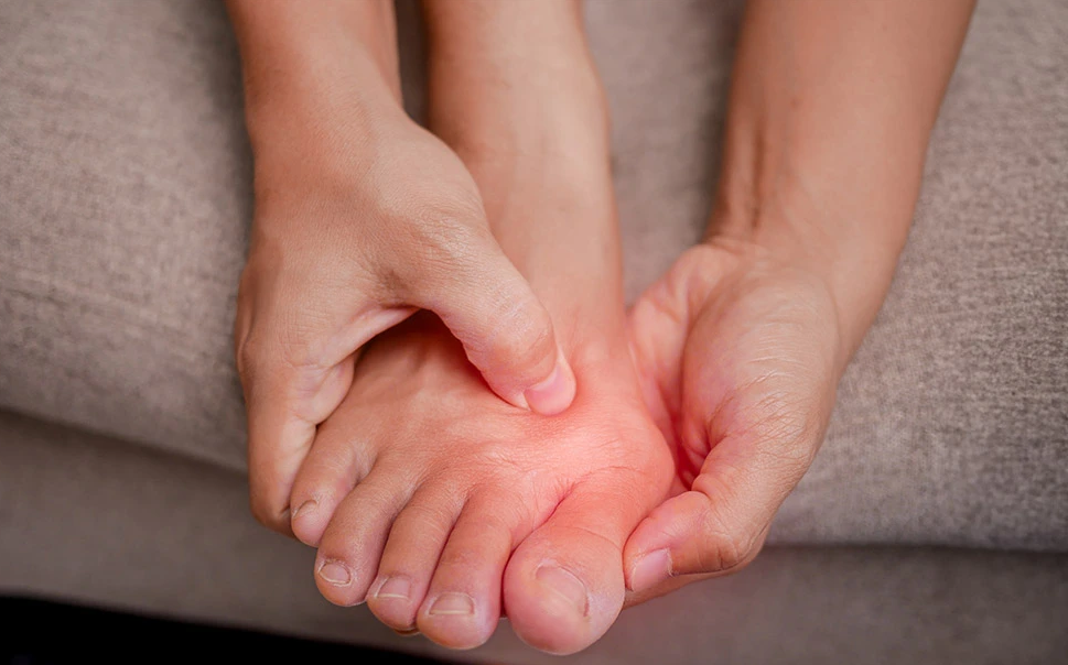 ¿Juanete? Una deformidad progresiva del pie que puede afectar la calidad de vida